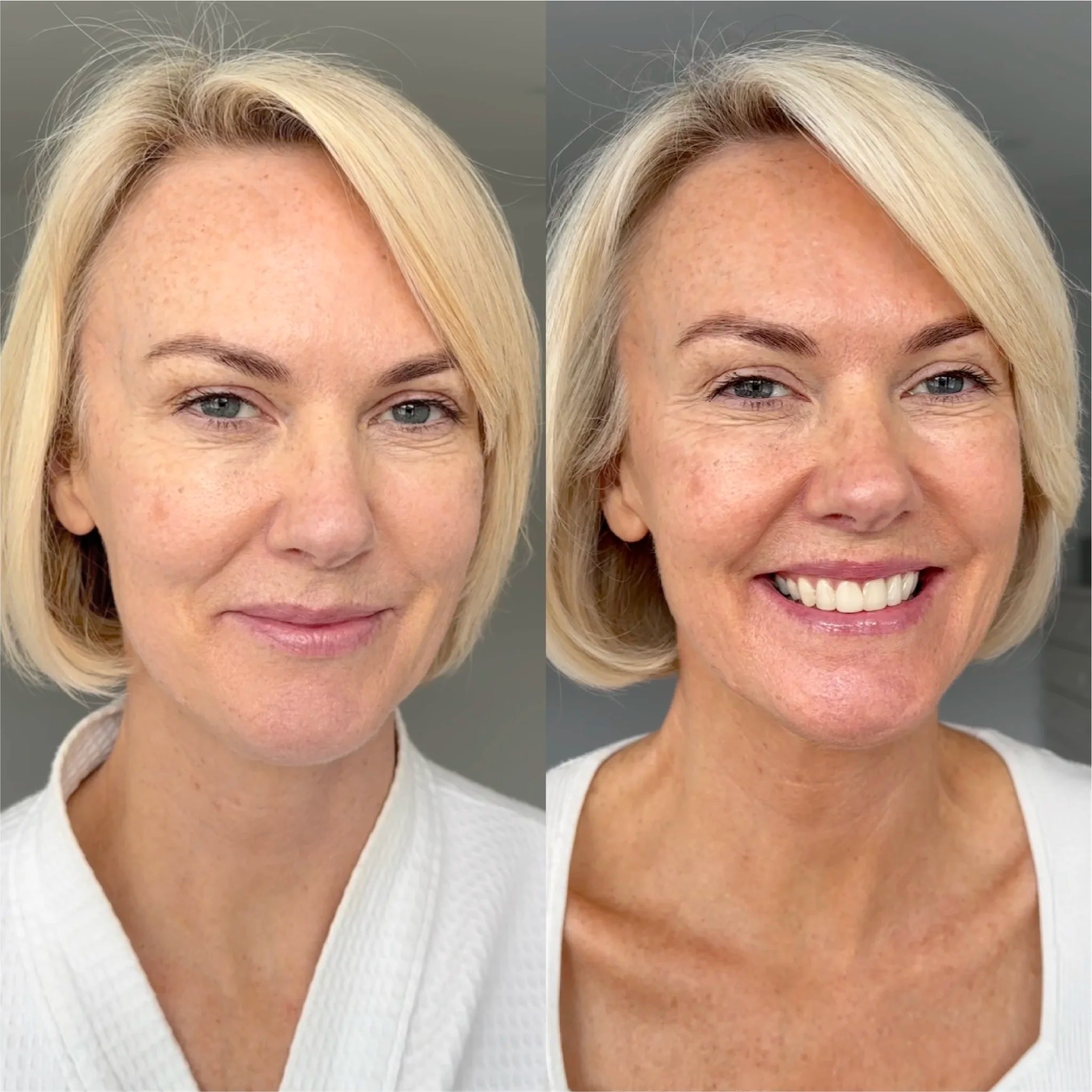 Before and After Sienna X Self Tan Concentrated Serum Drops