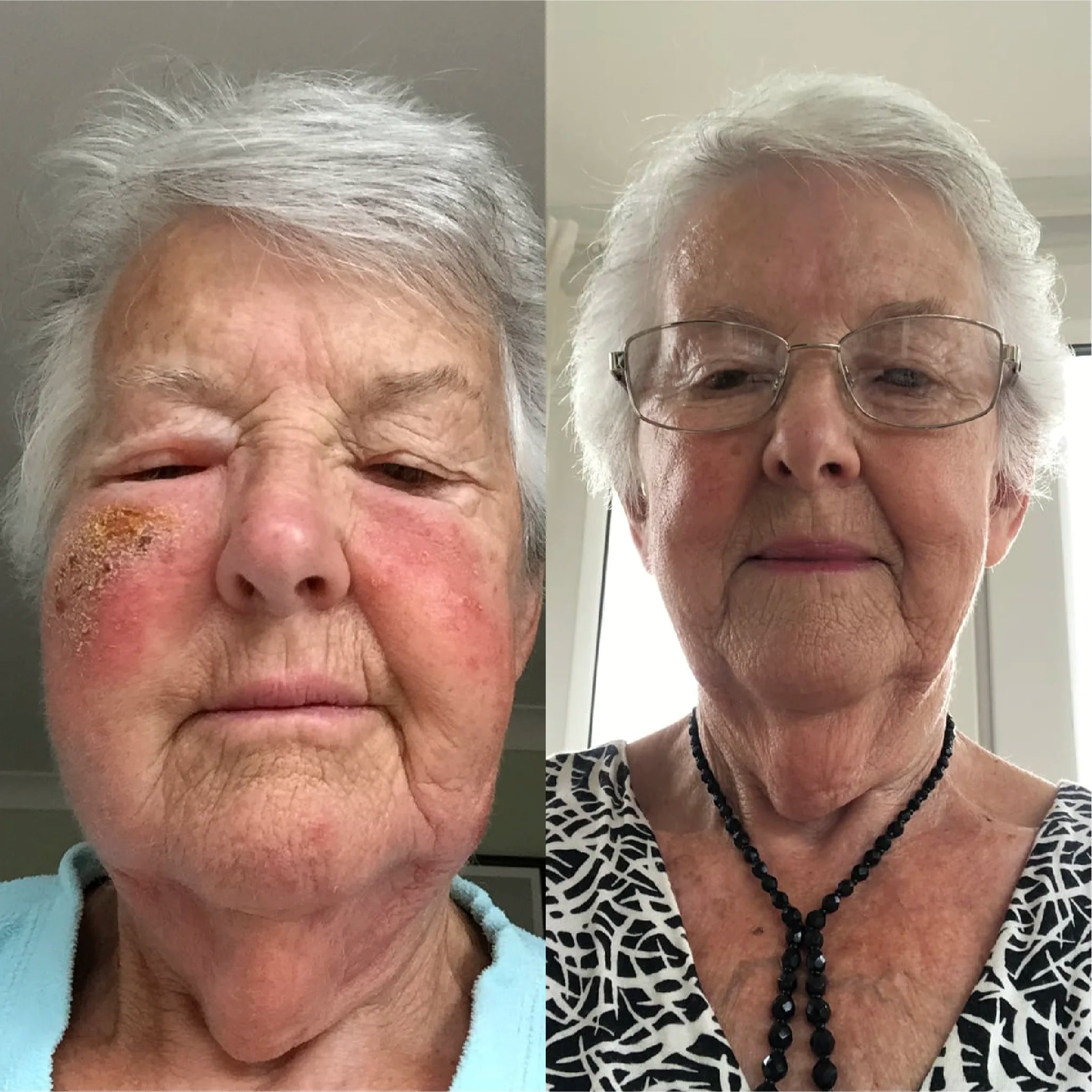 Sienna X Day Cream Results