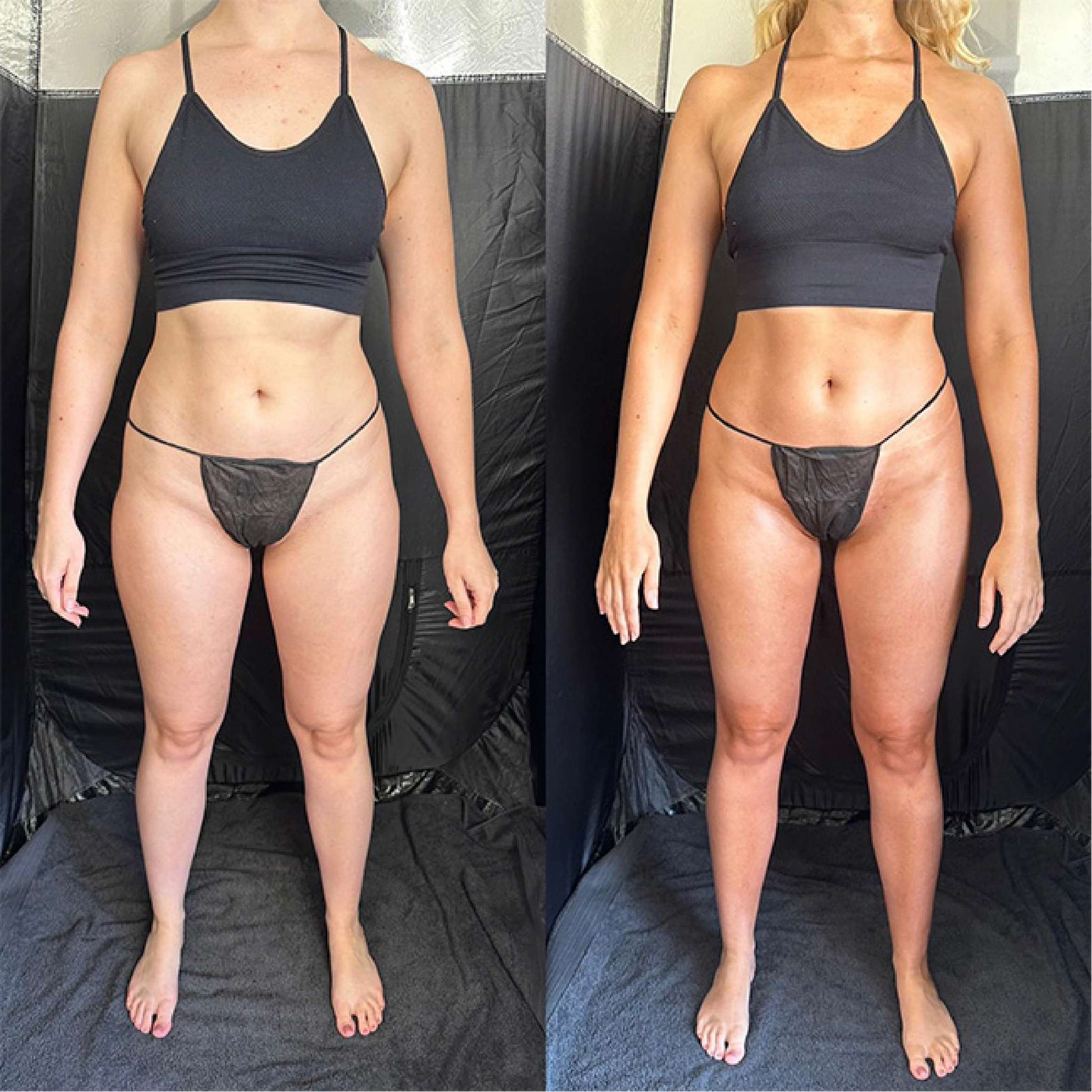 Sienna X | Olive Tan Medium - Dark Spray Tan Solution Bundle Before & After