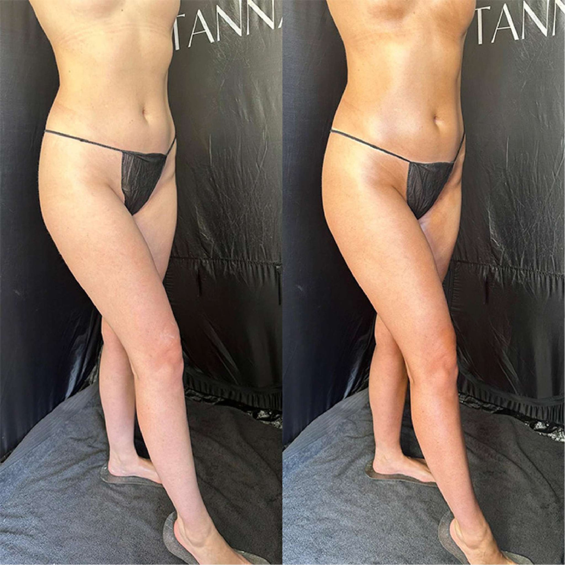 Sienna X | Olive Tan 1hr+ Express Spray Tan Solution (1 Litre Bundle) Before & After
