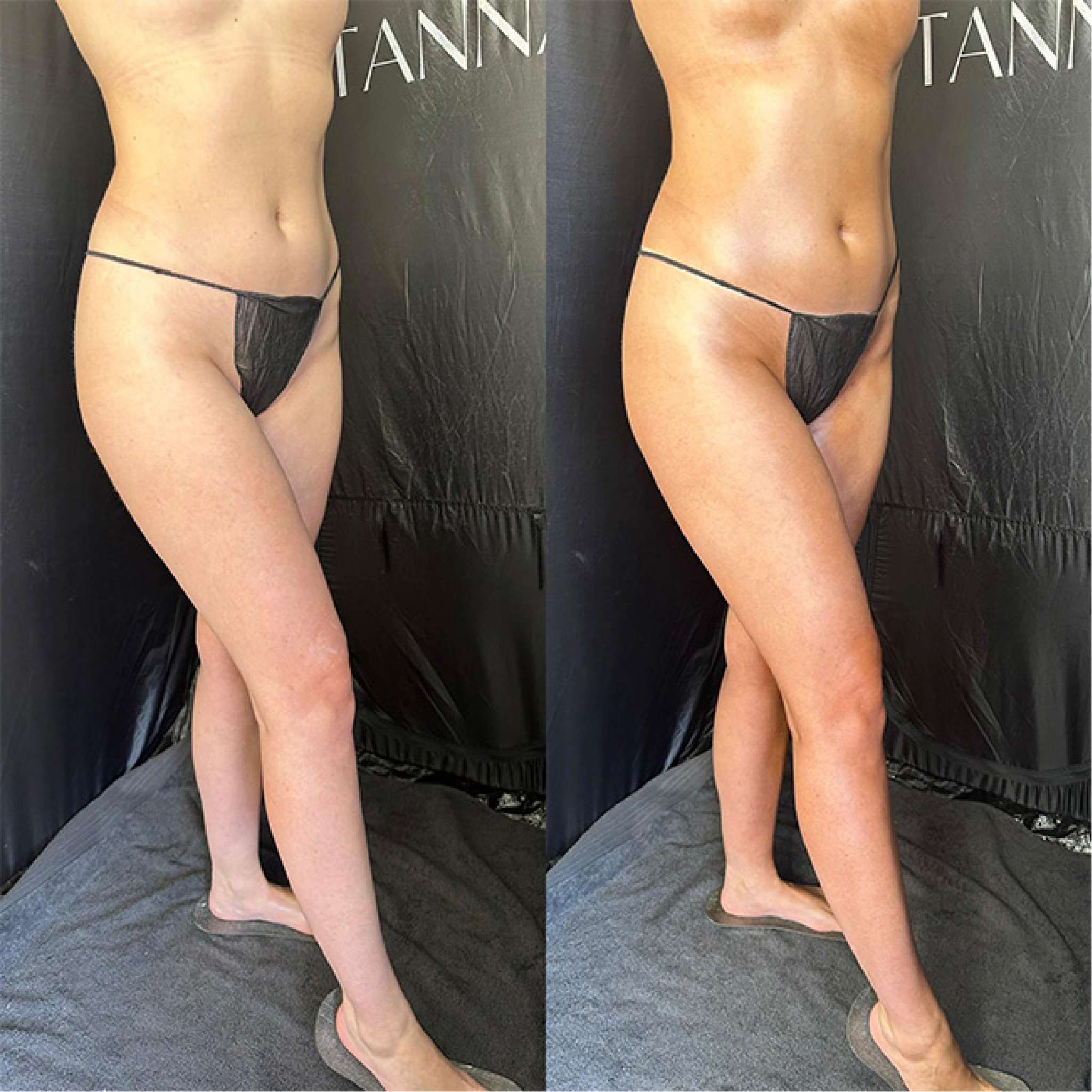 Sienna X | Olive Tan 1hr+ Express Spray Tan Solution (1 Litre Bundle) Before & After