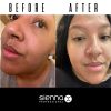 before after cleansing lotion dani 1